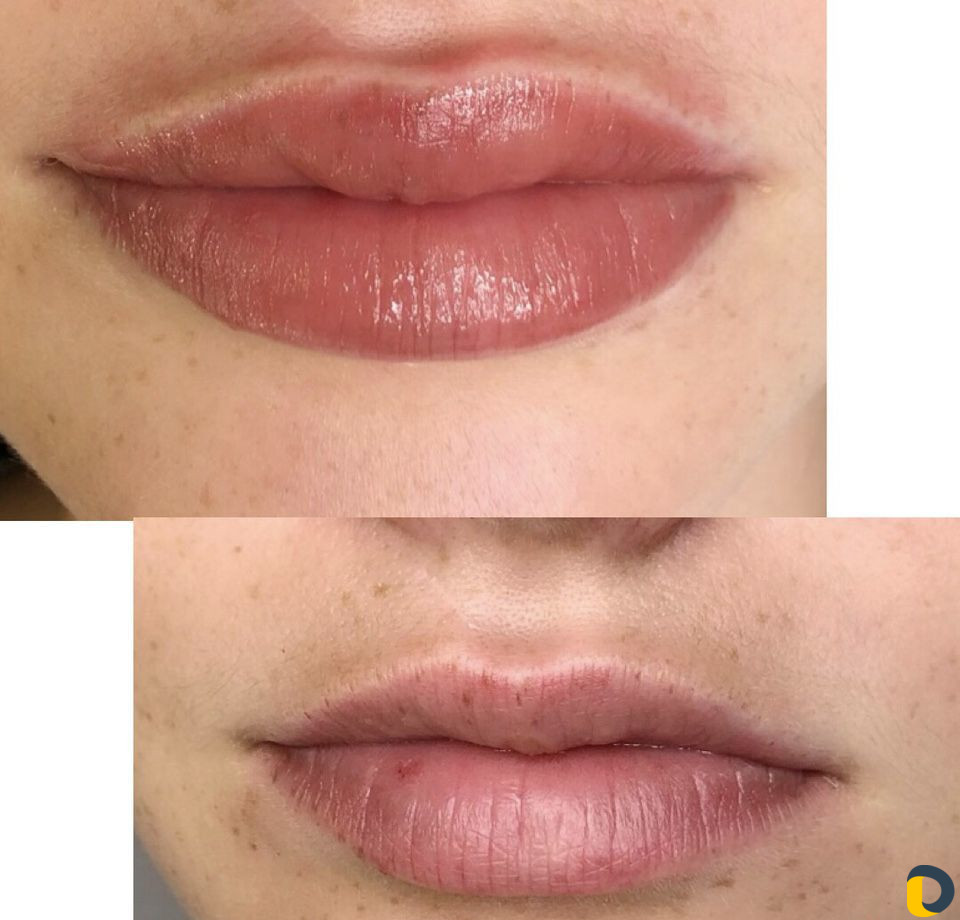 Аппаратное пудровое напыление бровей