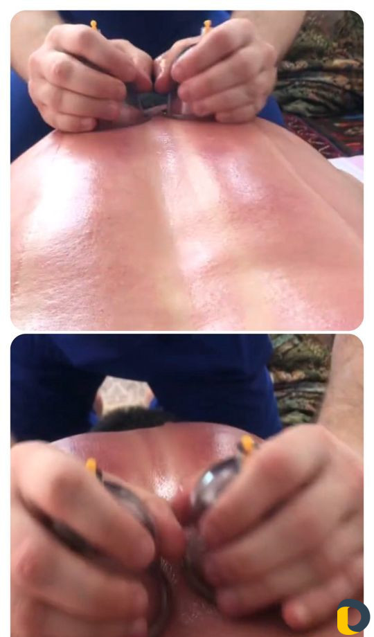 Авторский массаж