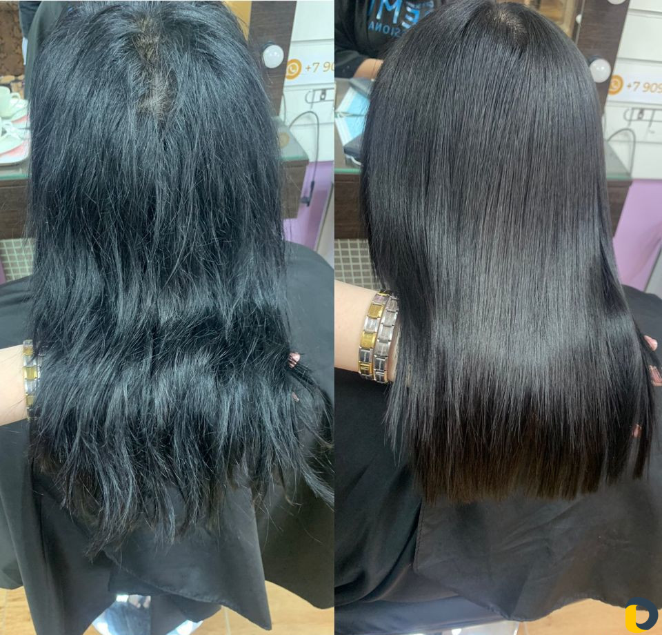 Ботокс, нанопластика, кератин, биксипластия