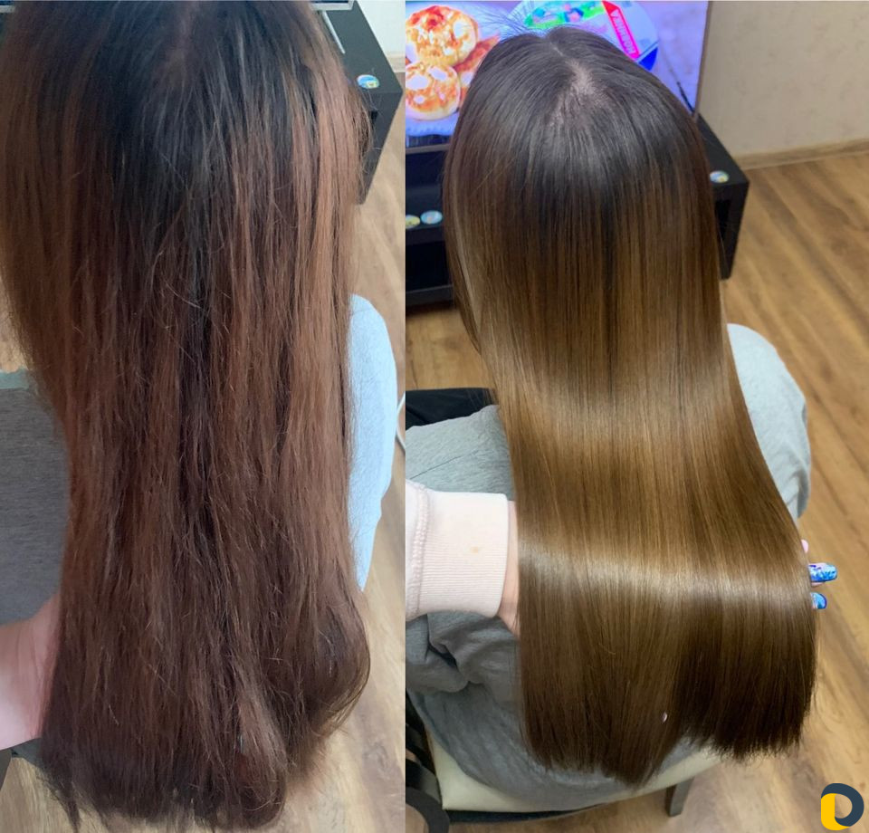 Ботокс, нанопластика, кератин, биксипластия