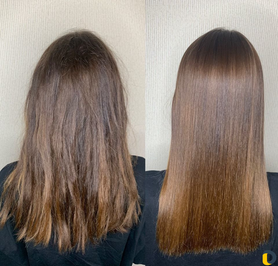 Ботокс, нанопластика, кератин, биксипластия