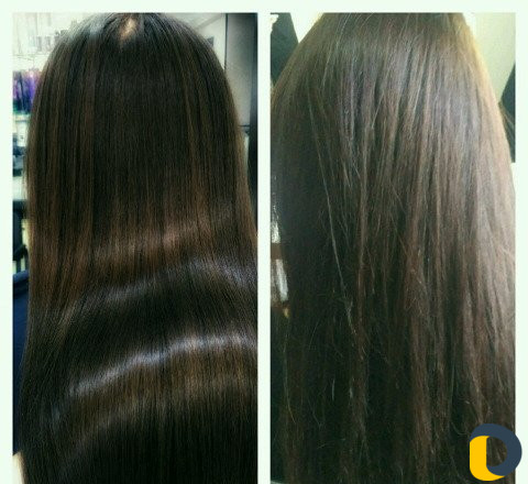 Ботокс, Нанопластика, Кератин