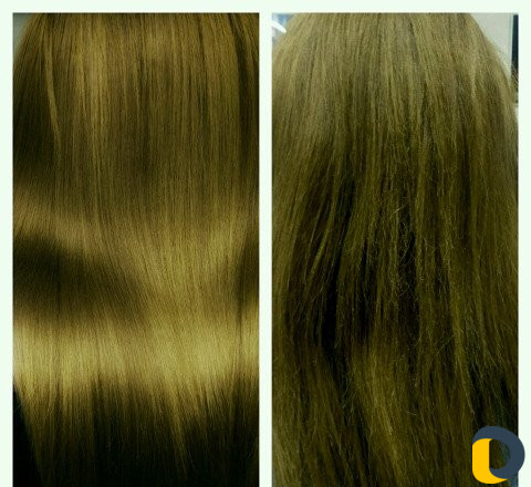 Ботокс, Нанопластика, Кератин