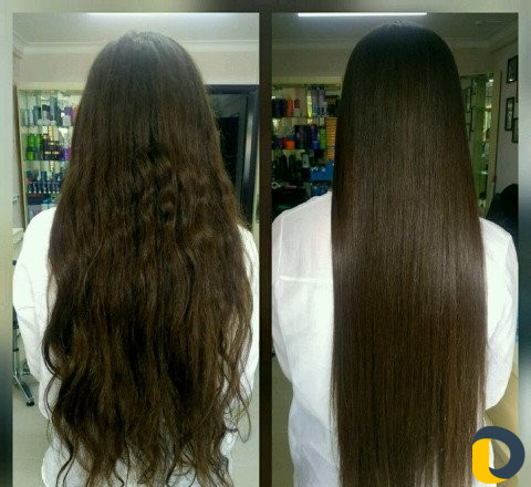 Ботокс, Нанопластика, Кератин