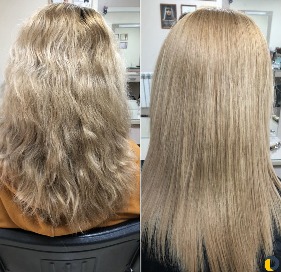 Ботокс в горячей технике