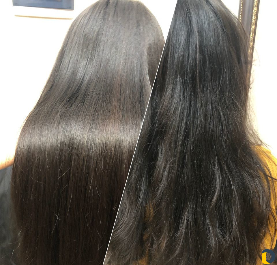 Ботокс в горячей технике