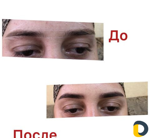 Бровист
