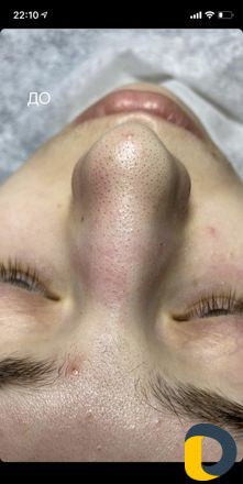 Чистка лица Holy Land