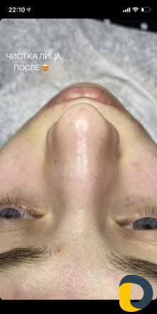 Чистка лица Holy Land