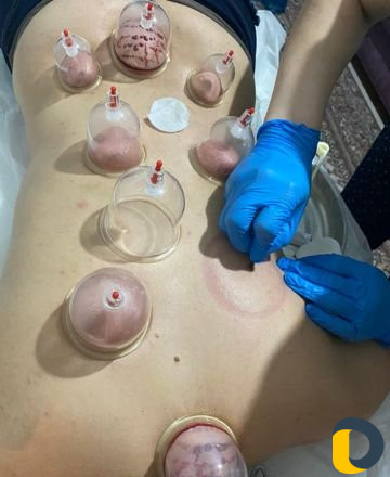 Делаю массаж детям и женщинам, Лечебный Антицеллюл