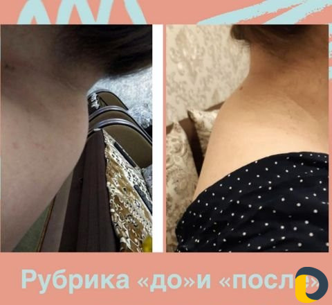Делаю массаж детям и женщинам, Лечебный Антицеллюл