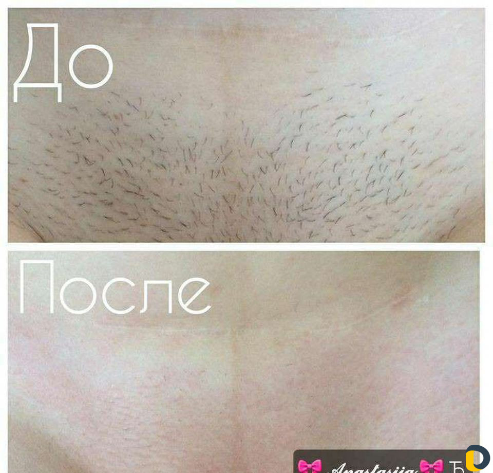 Депиляция, Брови,Ламинирование