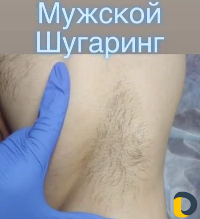 Депиляция для мужчин