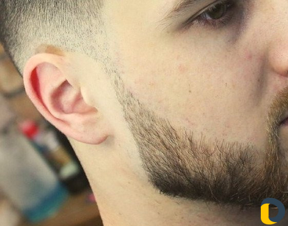 Депиляция (Шугаринг) для мужчин, коррекция бороды
