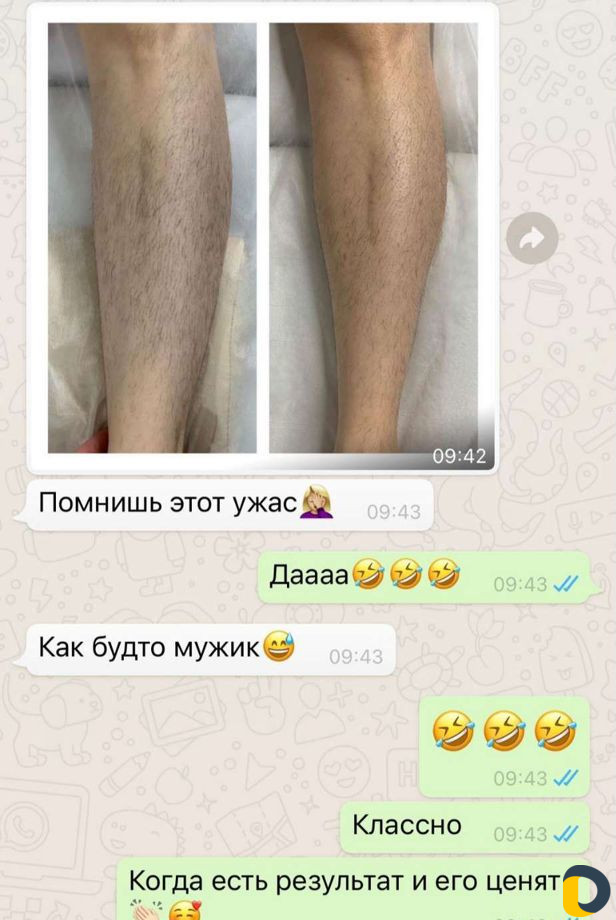 Депиляция Шугаринг Гелевая эпиляция Гелинг