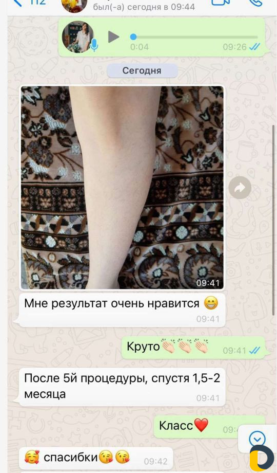 Депиляция Шугаринг Гелевая эпиляция Гелинг