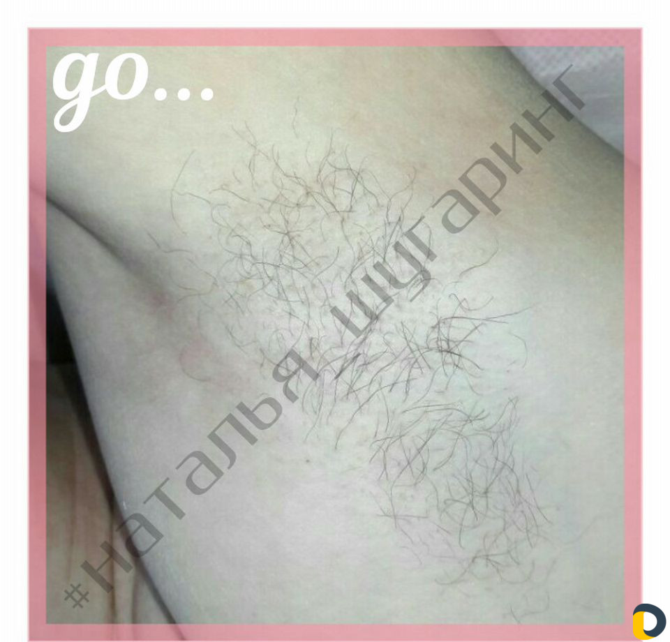 Депиляция шугаринг skin'S ваксинг Кератиновое выпр