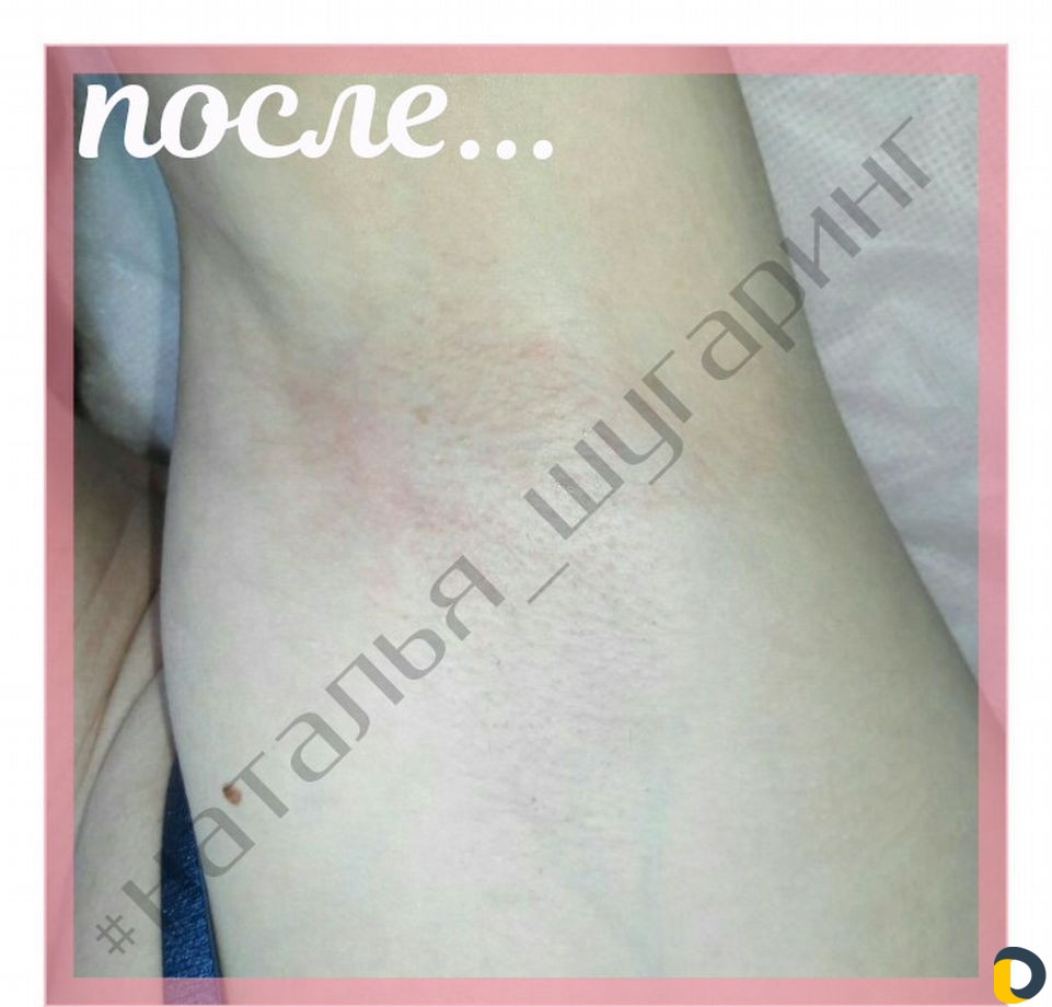 Депиляция шугаринг skin'S ваксинг Кератиновое выпр