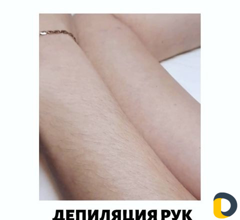 Депиляция воском