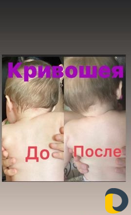 Детский и женский массажист