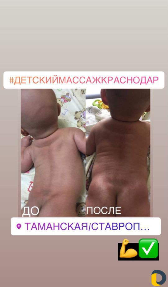 Детский массаж в Краснодаре