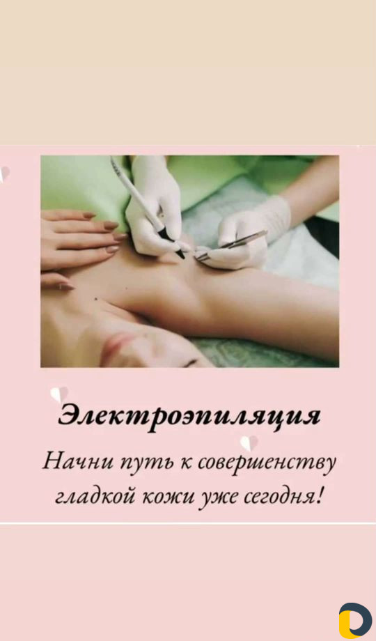 Электроэпилация