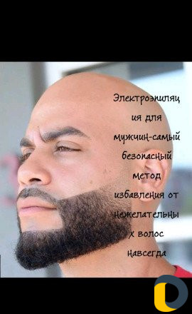 Электроэпиляция (мужской и женский прием )