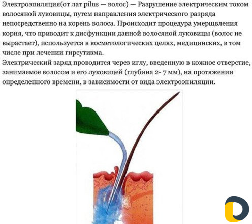 Электроэпиляция на дому.(Дербент.микр.р. Южный)