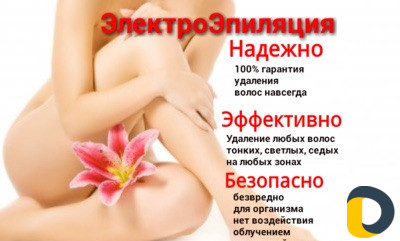 Электроэпиляция