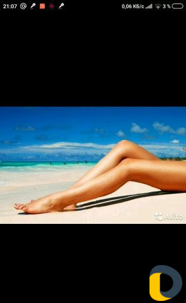 Электроэпиляция