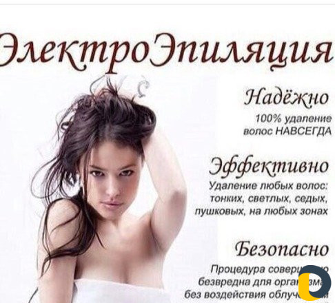 Электроэпиляция