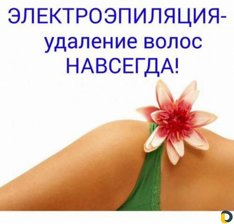 Электроэпиляция