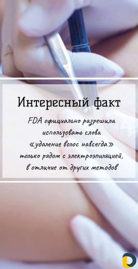 Электроэпиляция