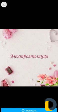 Электроэпиляция