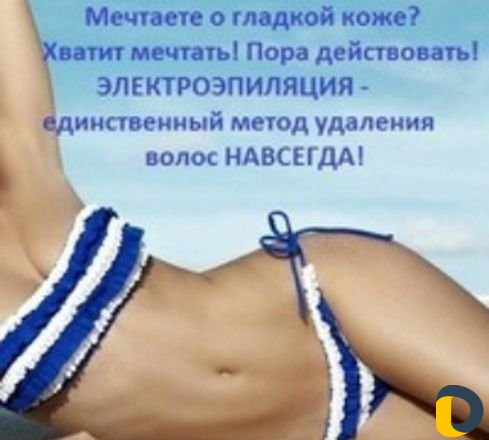 Электроэпиляция