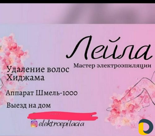 Электроэпиляция