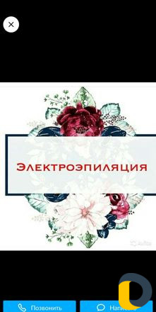 Электроэпиляция