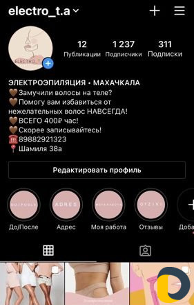 Электроэпиляция