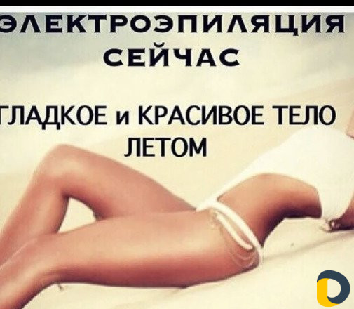 Электроэпиляция