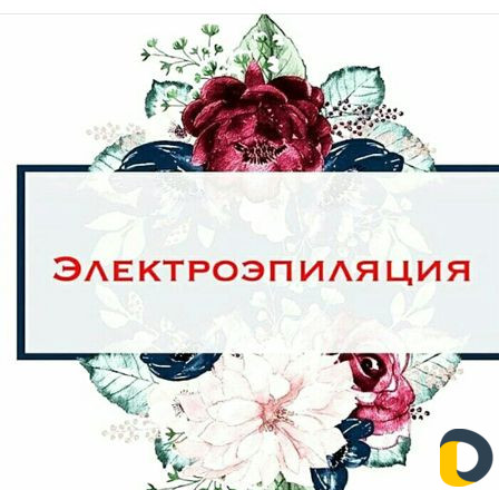 Электроэпиляция