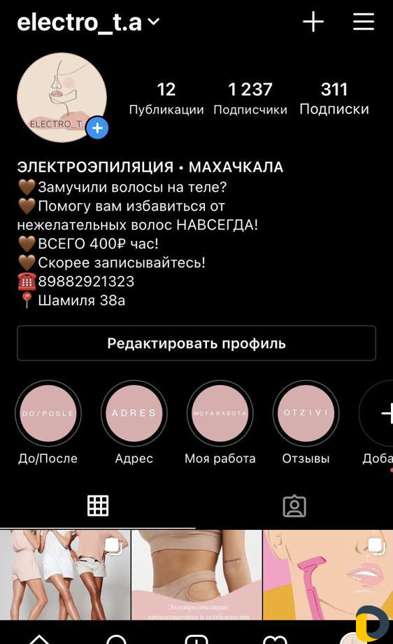 Электроэпиляция