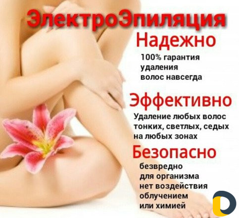 Электроэпиляция