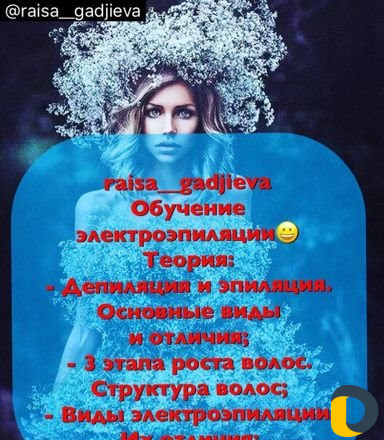 Электроэпиляция