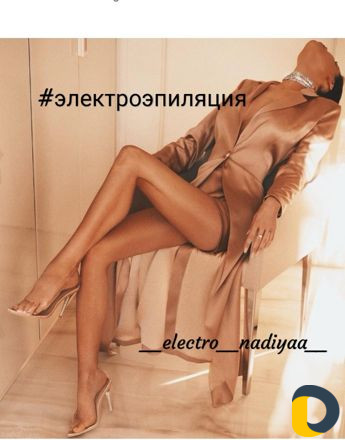 Электроэпиляция