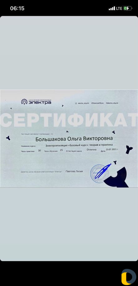 Электроэпиляция