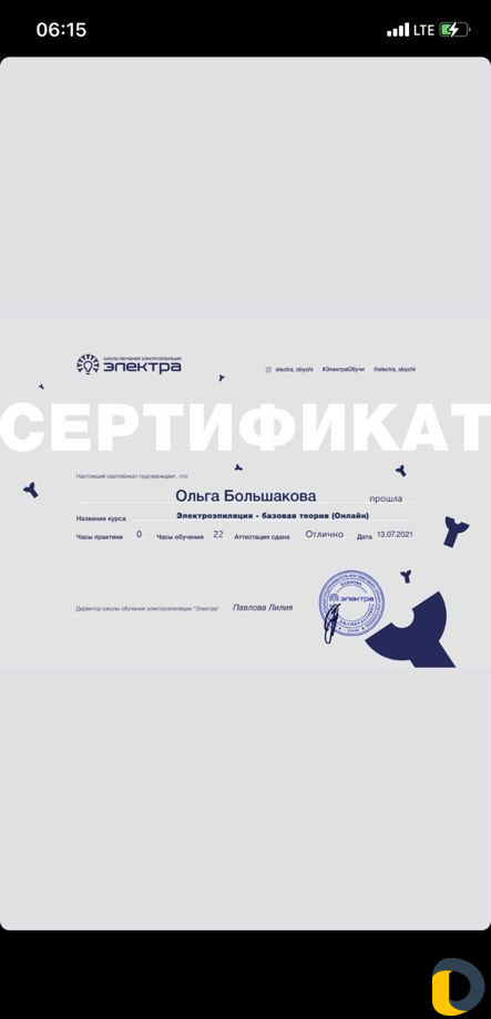 Электроэпиляция