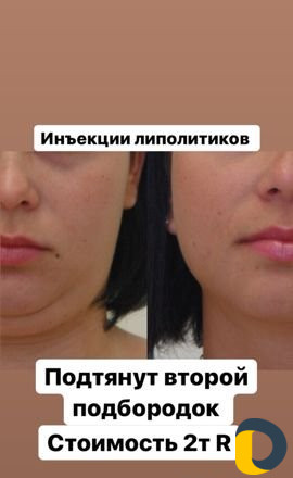Эпиляция,шугаринг,ламинирование