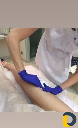 Эпиляция воском на дому