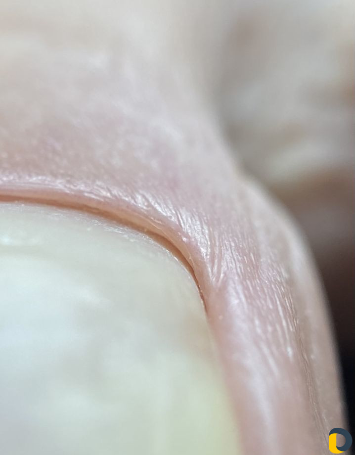 Эстетический педикюр