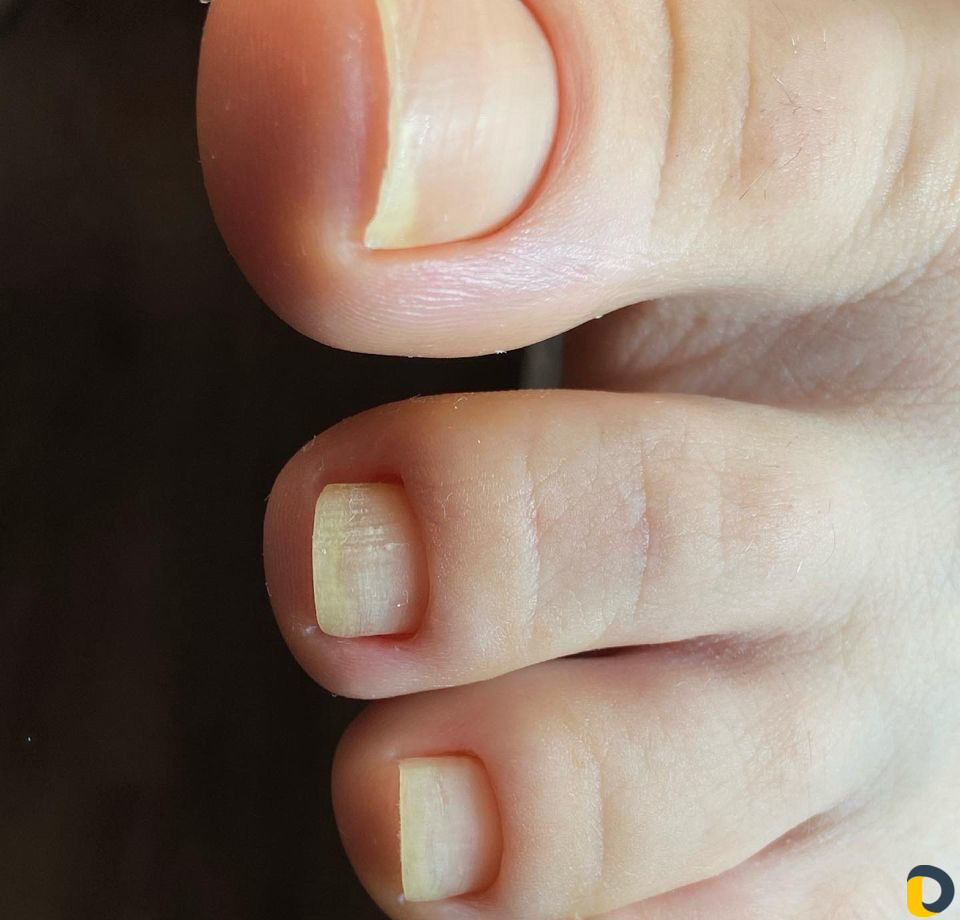 Эстетический педикюр